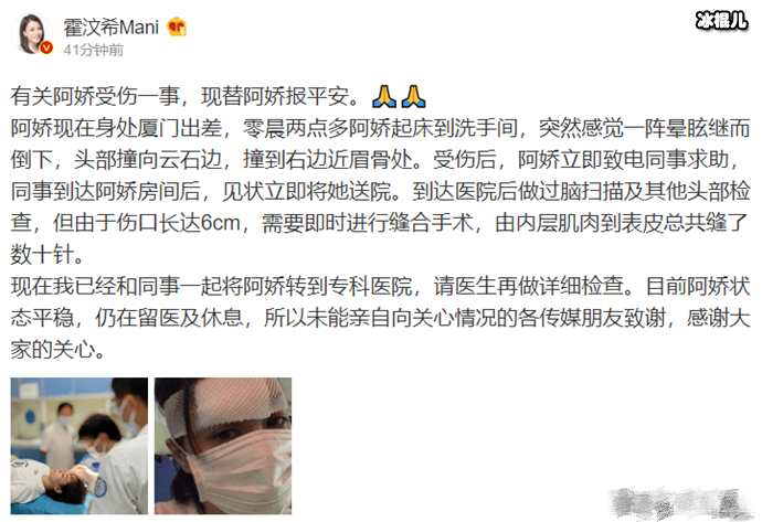 【WPT扑克】敬业！阿娇眉骨受伤坚持复工拍戏，杀青照用手遮掩伤疤