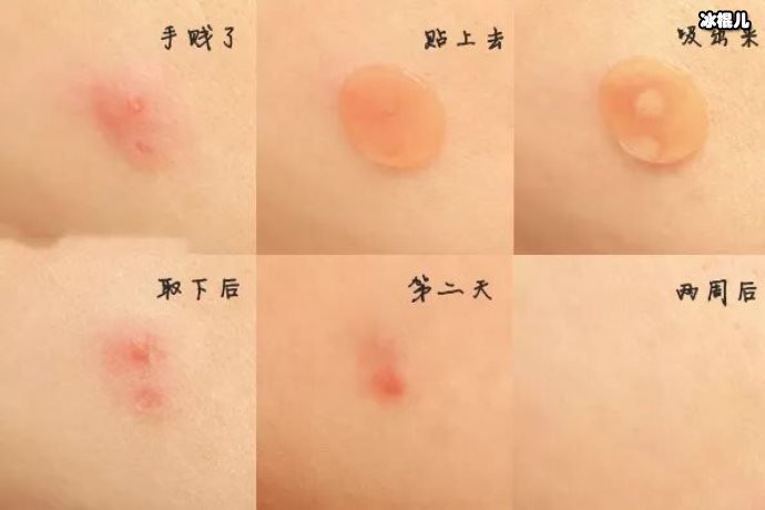 【WPT扑克】女生节战“痘”指南，呵护你的美