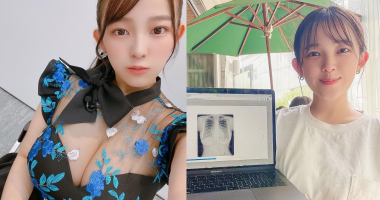 【WPT扑克】不忍了！「I 級身材」總被質疑是假的　女星「天木純」曬 X 光片打臉網友