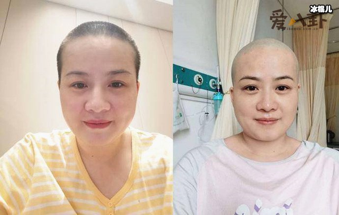 【WPT扑克】岳云鹏老婆回应生病剃光头！ 她得了什么病身体现状如何