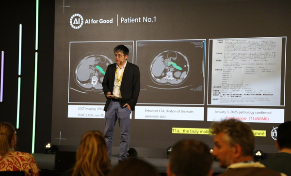 【WPT扑克】阿里达摩院公布多癌早筛AI最新进展：已服务2000万人次